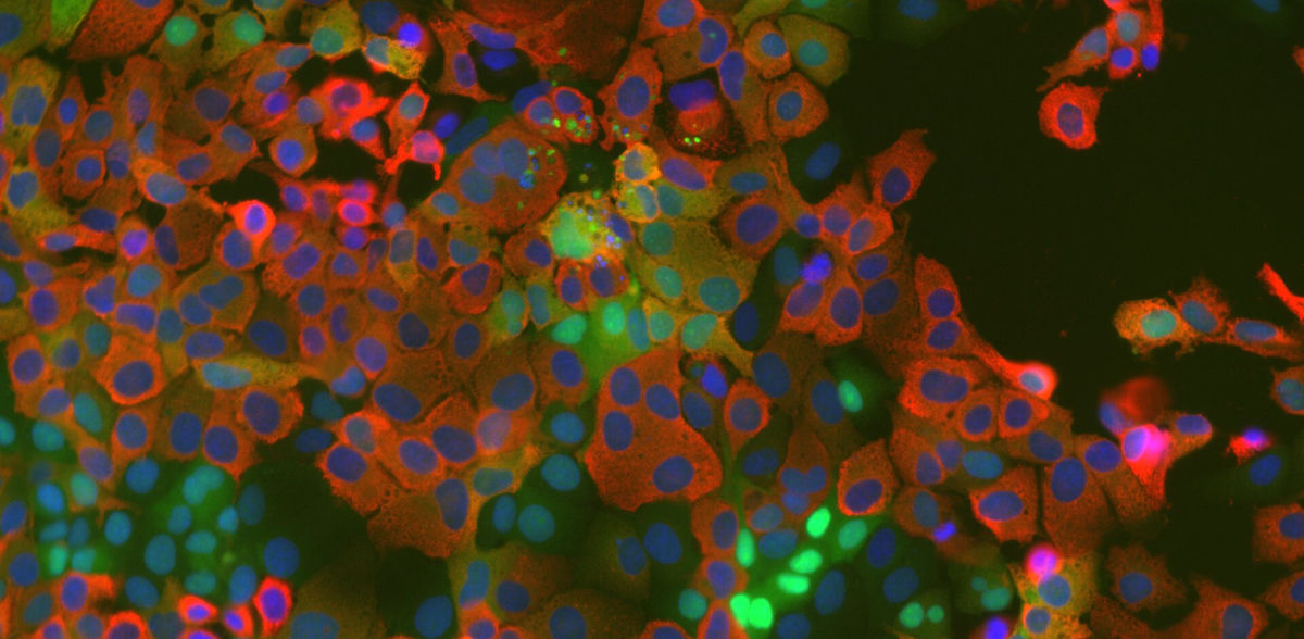 Newly Discovered Host Mechanism in Coronaviruses